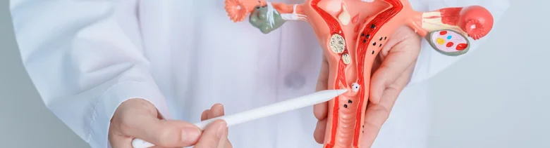 Lékař ukazuje polyp na děložním čípku pomocí modelu.