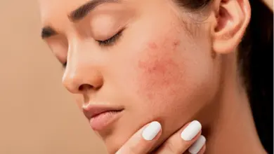 Žena s červenými skvrnami na tváři ukazuje příznaky akné nebo růžovky.