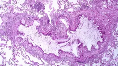 Bronchial tissue histology
