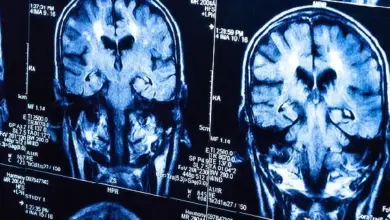 Magnetická rezonance mozku pro diagnostiku nádorů