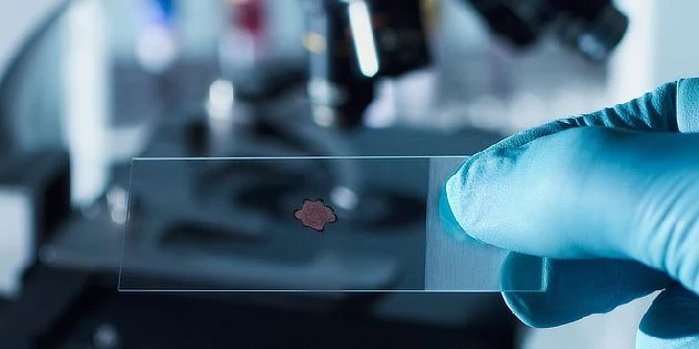 Ruka drží mikroskopický sklíček s biologickým vzorkem v laboratoři.